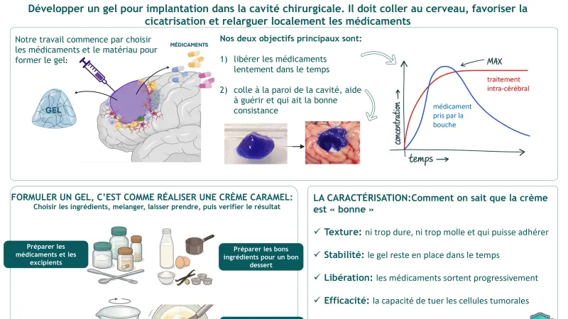 Développement d’un traitement local pour éviter les récidives dans le glioblastome