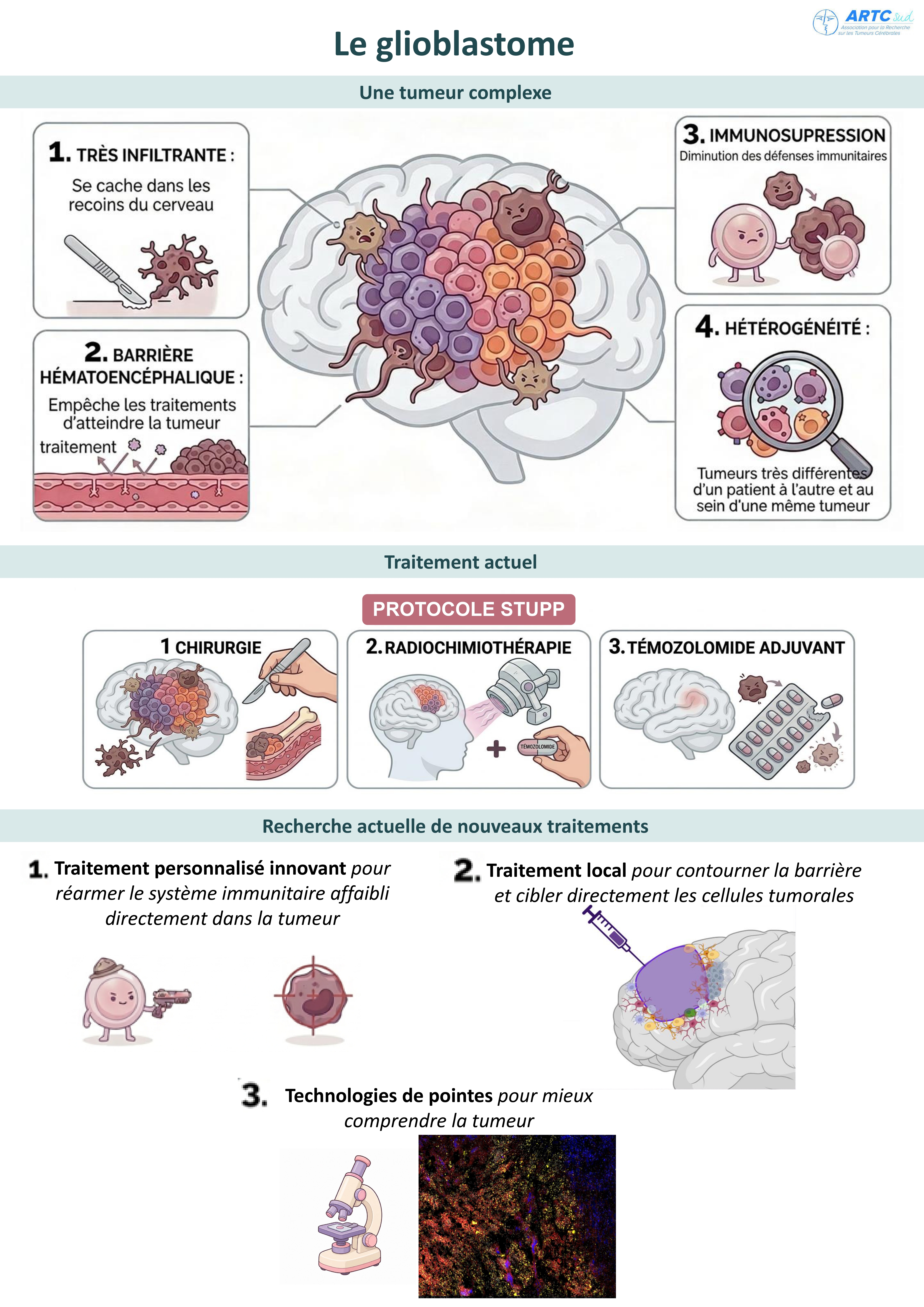 Le glioblastome