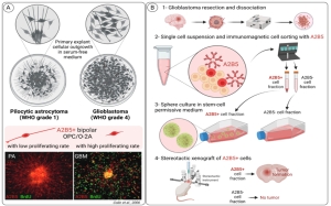 A2B5 Expression in Central Nervous System and Gliomas